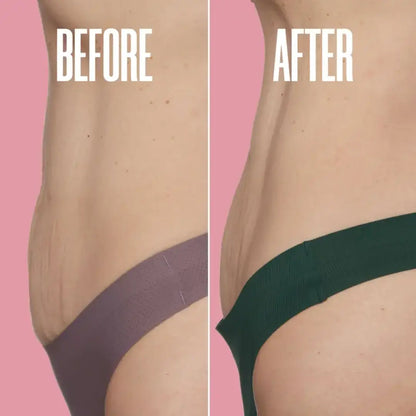 NORYVENA Overnight Toning Body Whip