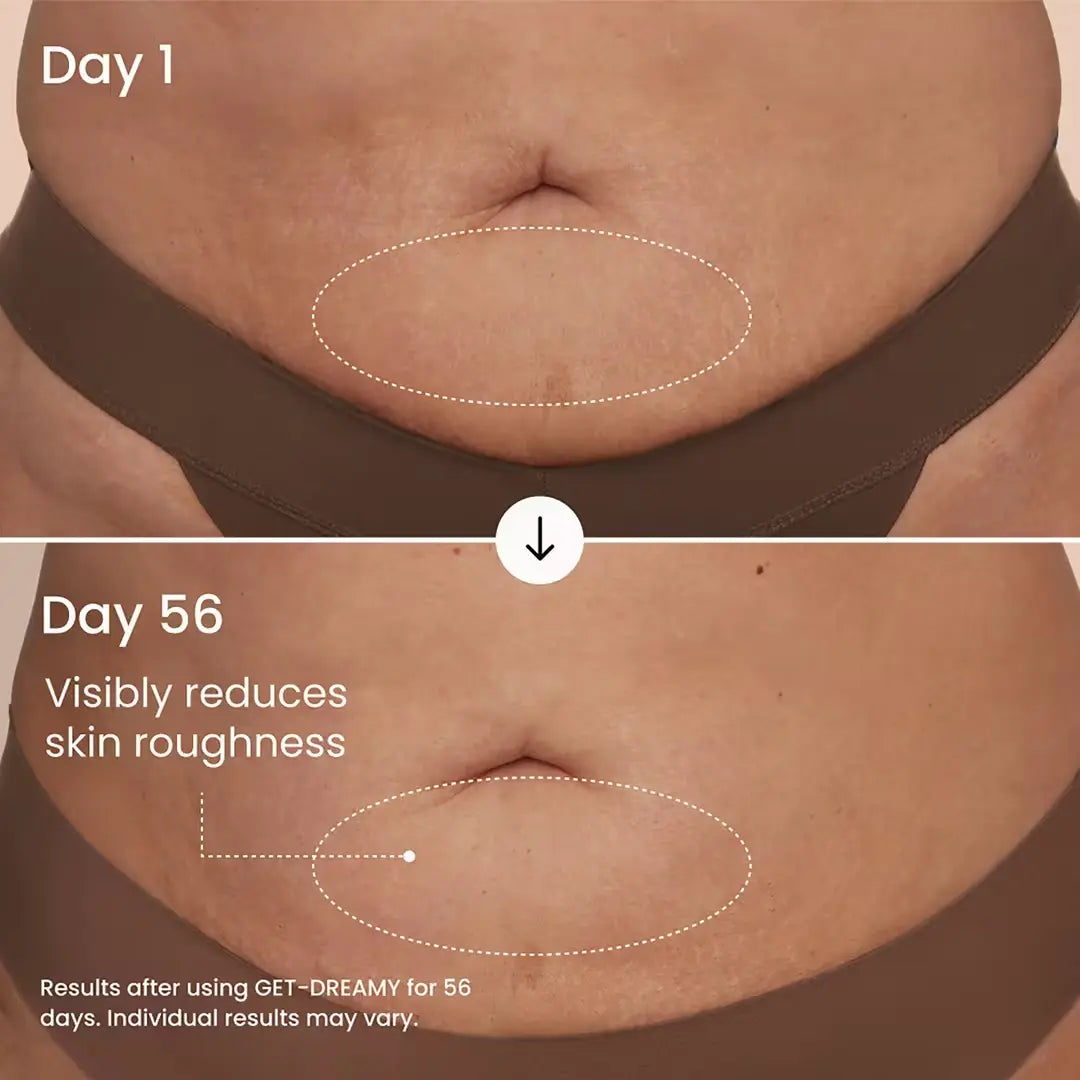 NORYVENA Overnight Toning Body Whip
