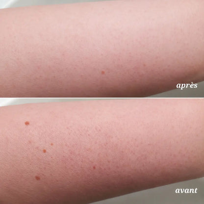 Body Peel Shot à l’Acide Hypochloreux | Sérum Exfoliant Doux pour le Corps contre les Cellules Mortes, les Zones Rugueuses et la Texture Irrégulière | Extrait de Riz et Panthénol pour une Hydratation et un Soin Lissant