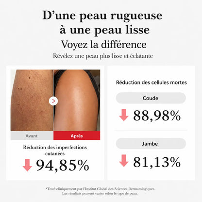 Body Peel Shot à l’Acide Hypochloreux | Sérum Exfoliant Doux pour le Corps contre les Cellules Mortes, les Zones Rugueuses et la Texture Irrégulière | Extrait de Riz et Panthénol pour une Hydratation et un Soin Lissant